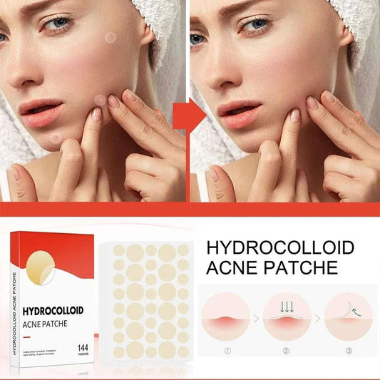 144pcs/set Face High-end Skin Care Pimple Acne Patches Professional Healing Absorbing Spot Sticker Covering  for Covering Acne