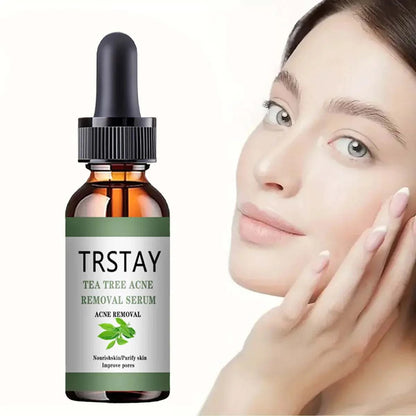 Acne Treatment Face Serum with Tea Tree Oil by TRSTAY for Moisturizing and Shrinking Pores.
