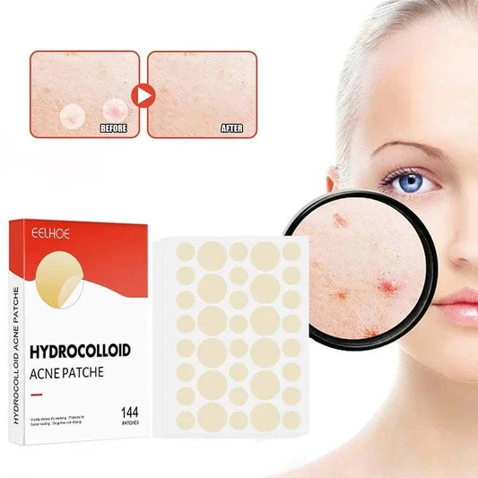 144-piece set of high-end hydrocolloid acne patches for face skin care, featuring professional absorption and healing for pimples.
