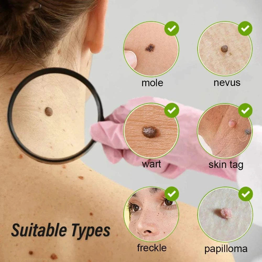 Laser Plasma Pen Mole Wart Remover Black Dots Freckle Dark Spot Remover Plasma Pen Wart Eliminator Papilloma Skin Tag Removal