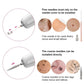 Laser Plasma Pen Mole Wart Remover Black Dots Freckle Dark Spot Remover Plasma Pen Wart Eliminator Papilloma Skin Tag Removal