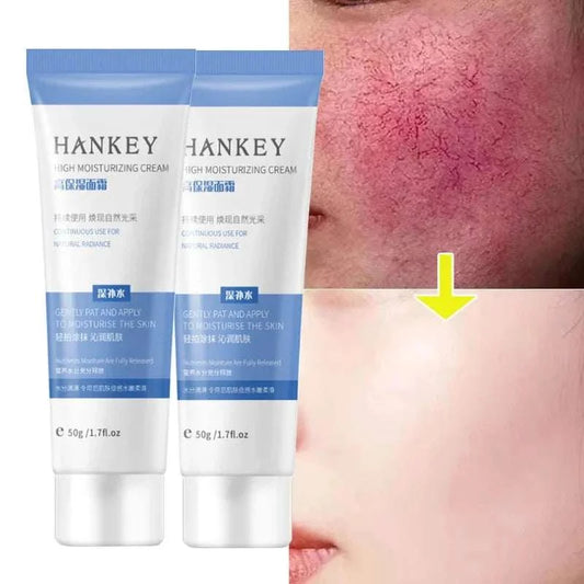 Facial Redness Repair Cream for sensitive skin, showing before and after results.