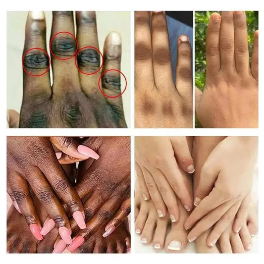 Dark Knuckles Fast Brighten Serum Skin Cracked Soft Moisturizer Hand Cream Elbows Knee Black Skin Lighten Stains Remover Product