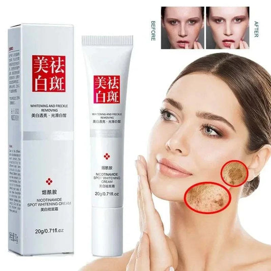 Fades Freckle Dark Spots Face Cream with Niacinamide and Vitamin E for Fast Skin Brightening and Nourishment.