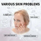 Acne Treatment Face Serum Tea Tree Oil Essence Moisturizing Shrink Pores Acne Facial Serum Korean Skin Care Products