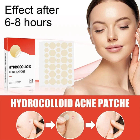 144pcs set hydrocolloid acne pimple patch for face skin care, effect visible after 6-8 hours.