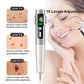 Laser Plasma Pen Mole Wart Remover Black Dots Freckle Dark Spot Remover Plasma Pen Wart Eliminator Papilloma Skin Tag Removal